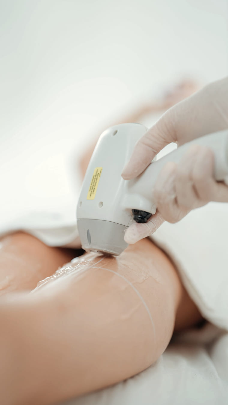 A laser handpiece pressed against the skin of a leg, cooling gel applied