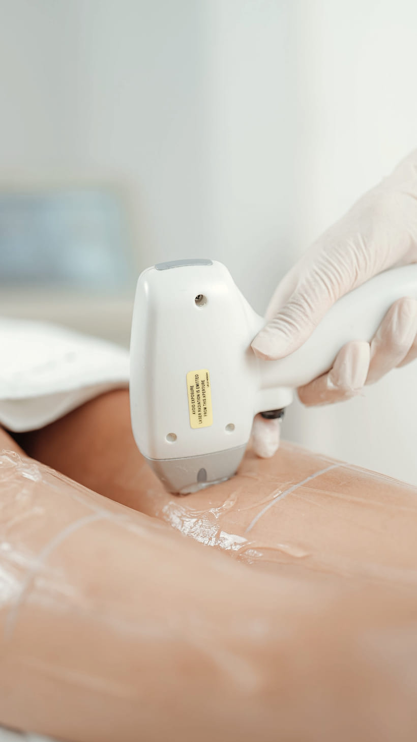 A laser handpiece passes along a client's forearm, the beam glowing amber against the skin
